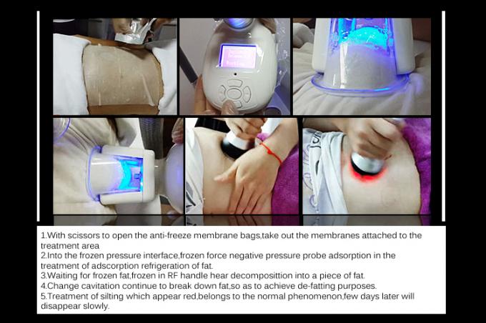Powerful!!!cryolipolysis machine/ultrasonic liposuction cavitation cryolipolysis fat freezing machine for sale