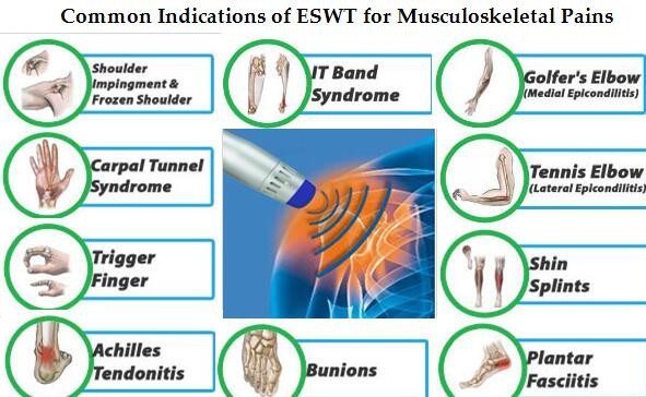 laser clinic use shock wave occupational physical therapy equipment