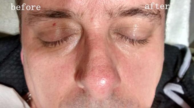 Instant Face Lift Hifu Machine Wrinkle Removal Machine High Intensity Focused